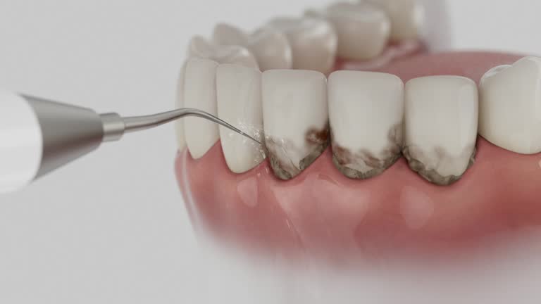 Reliable Dental contractor in Saratoga, WY by Dentist Open Now